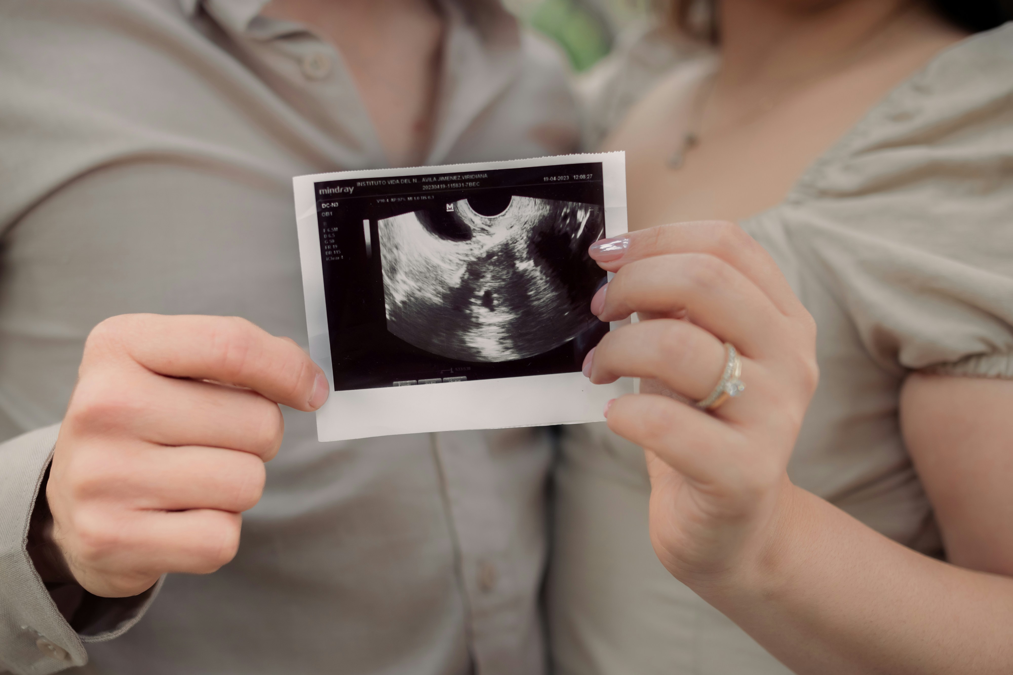 Early ultrasound of pregnancy